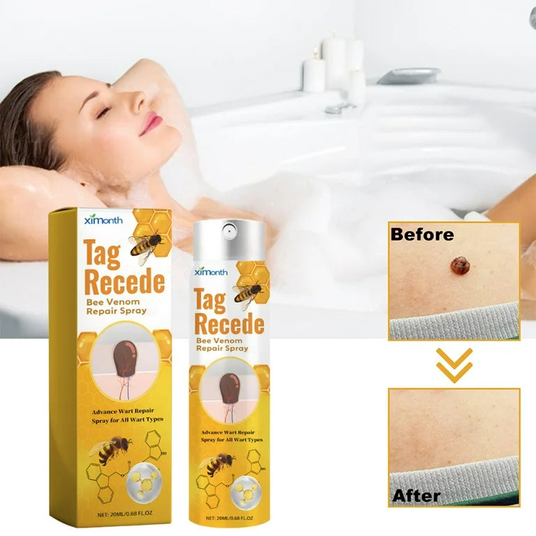 Eliminador de verrugas con veneno de abejas | Tag Recede™