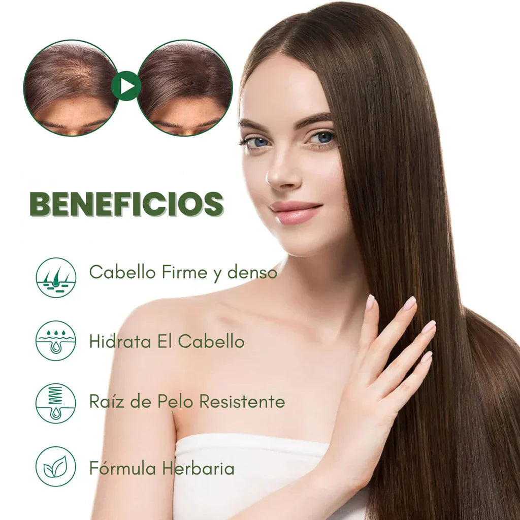 Ouhoe™ Elixir Capilar + Derma Roller de regalo: Recupera tu Cabello y detiene la caída, fórmula herbal con ginseng y jengibre