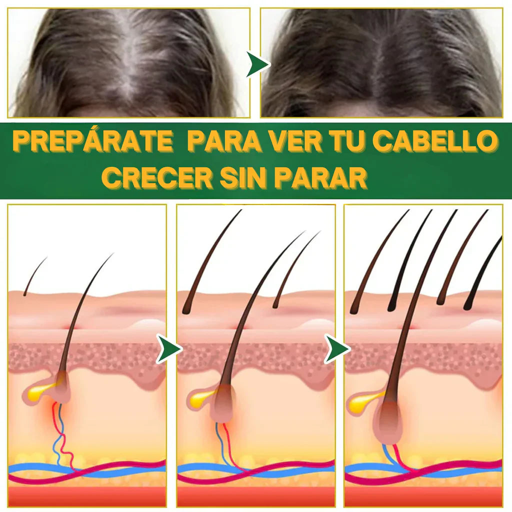 Ouhoe™ Elixir Capilar: Recupera tu Cabello y detiene la caída, fórmula herbal con ginseng + jengibre